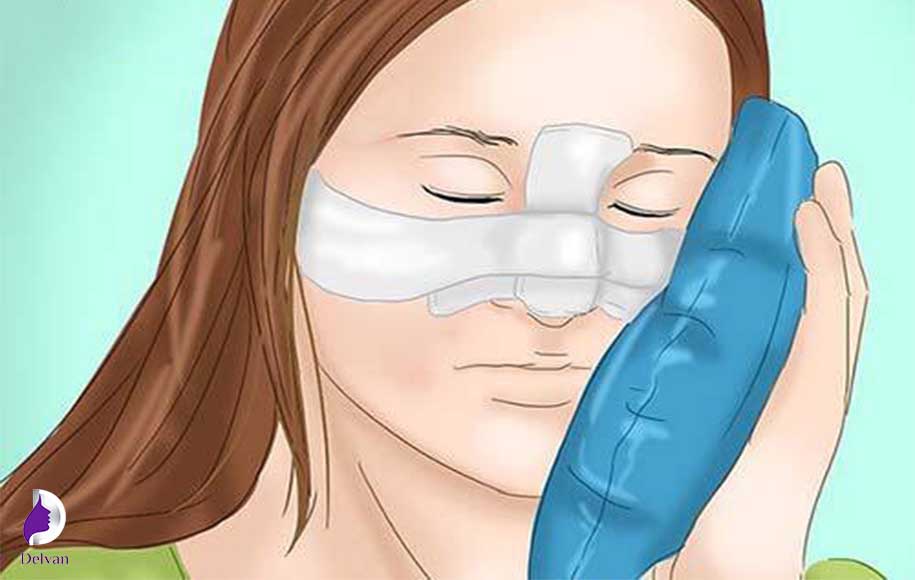 مراقبت های بعد از جراحی پلک