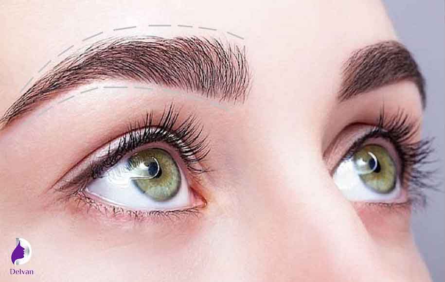 سن مناسب برای کاشت ابرو طبیعی