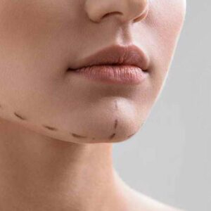 محدودیت های جراحی غبغب