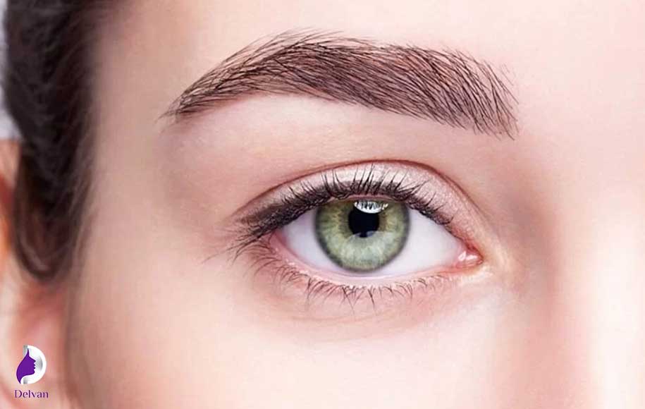 بهترین سن برای عمل کاشت ابرو