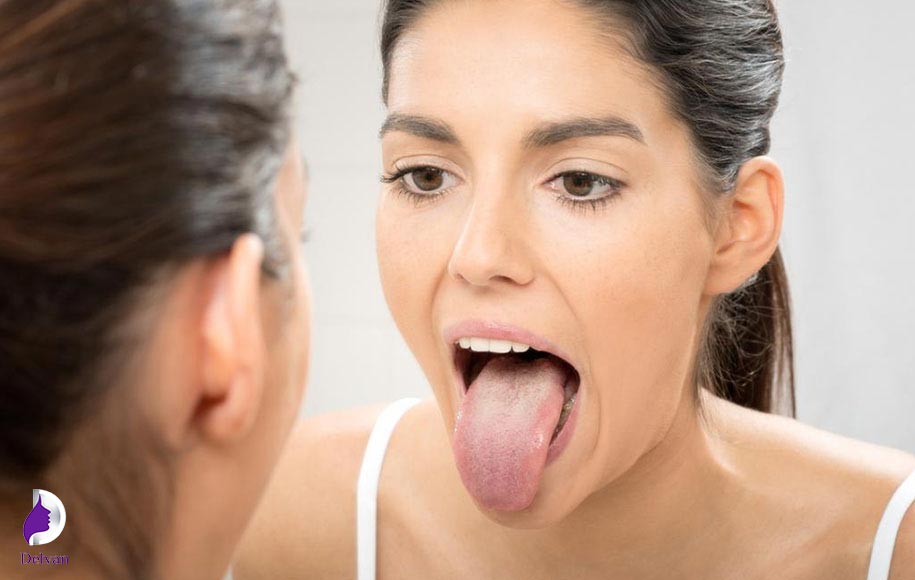 ورزش خمیازه شیر جهت فرم دهی به غبغب