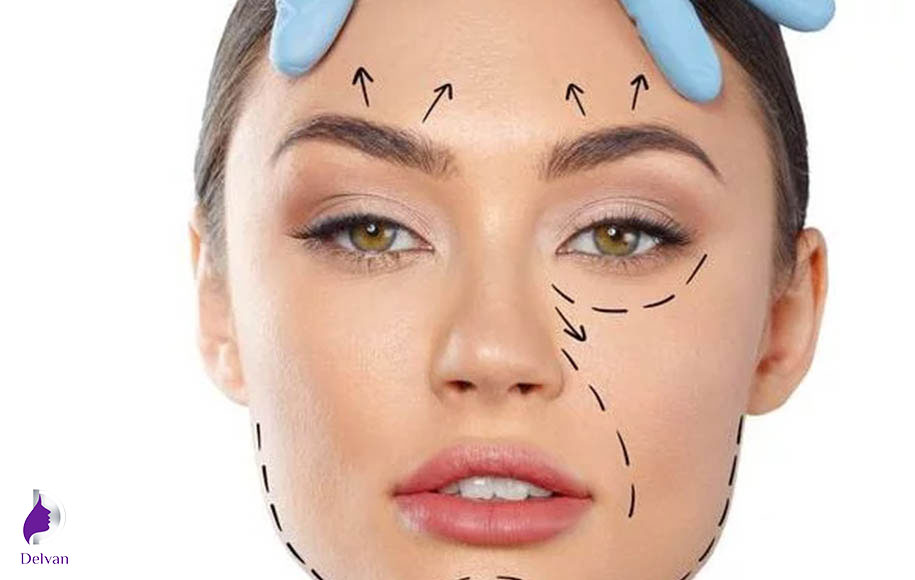 لیفت ابرو یا پیشانی
