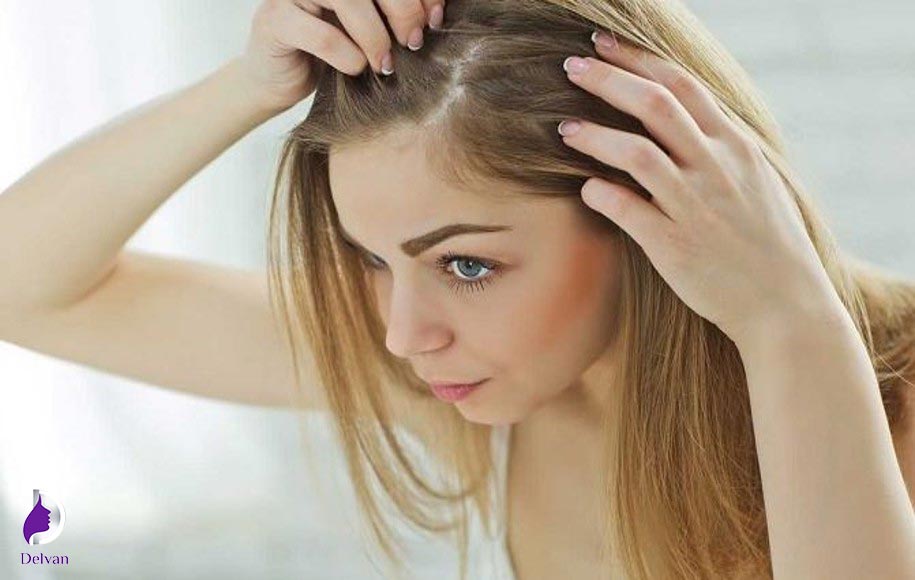 کاشت مو برای زنان و عوارض احتمالی آن