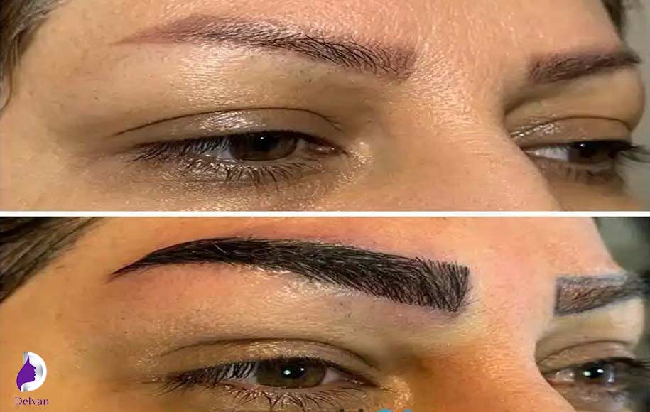 انواع روش های کاشت ابرو