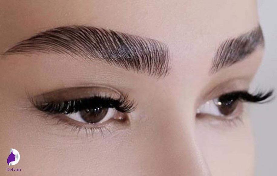 روش های کاشت طبیعی ابرو