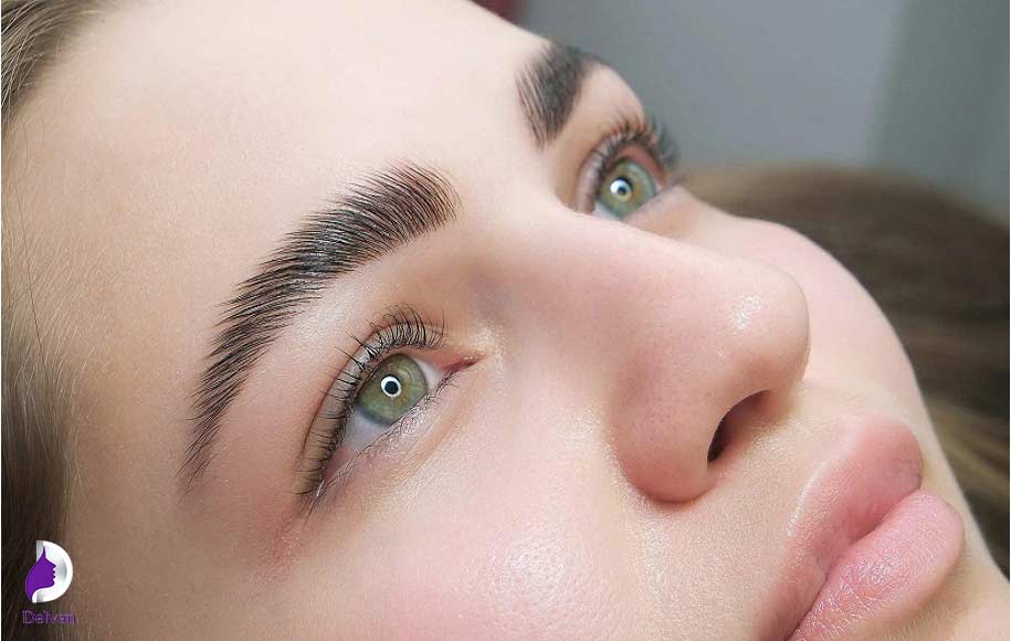 روش SUT برای کاشت ابرو چیست؟