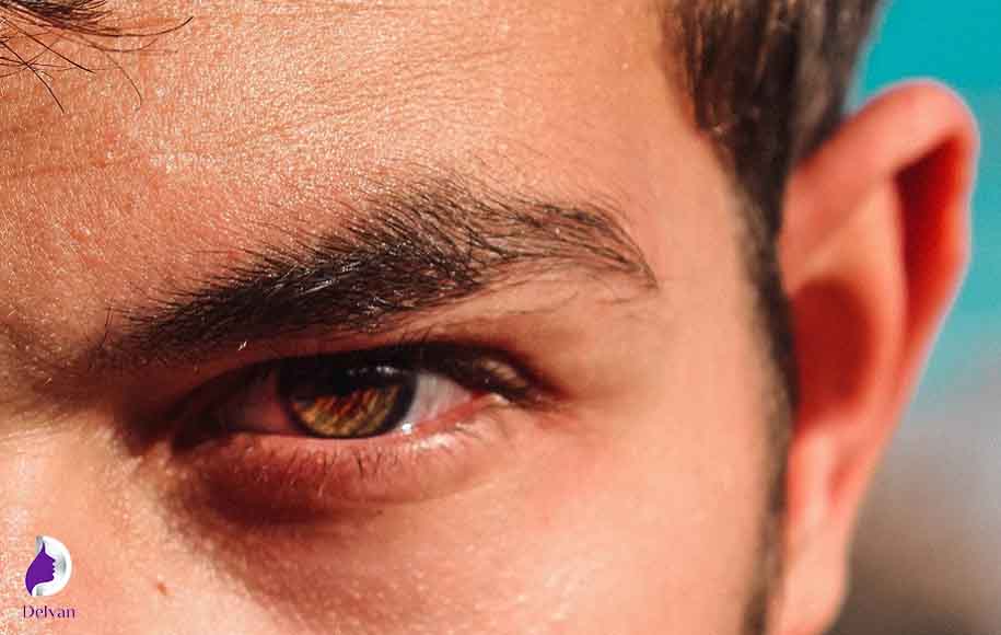 مراقبت‌های بعد از کاشت ابرو برای آقایان
