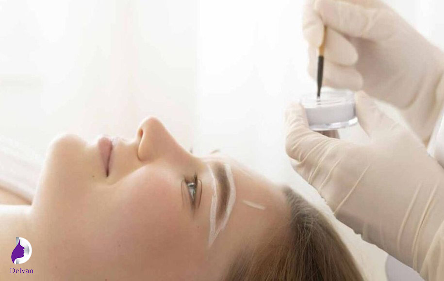 عدم ریزش ابرو با کاشت ابرو در کلینیک معتبر هالن