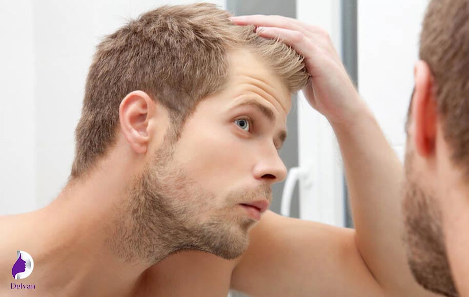 خطرات رنگ کردن مو بعد از کاشت مو