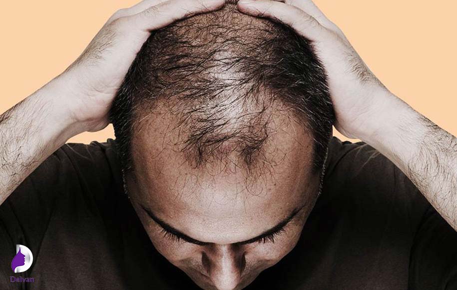 برای افزایش رشد مو چه کنیم