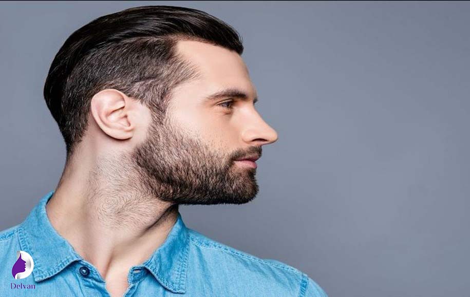 عمل بوکال فت برای آقایان