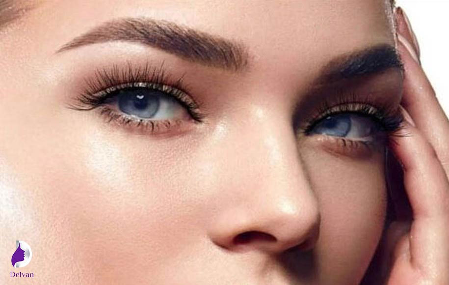 لیفت ابروهای کاشته شده