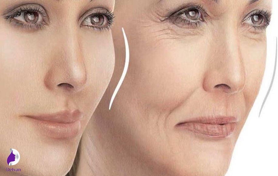 مراحل تزریق چربی به پشت پلک