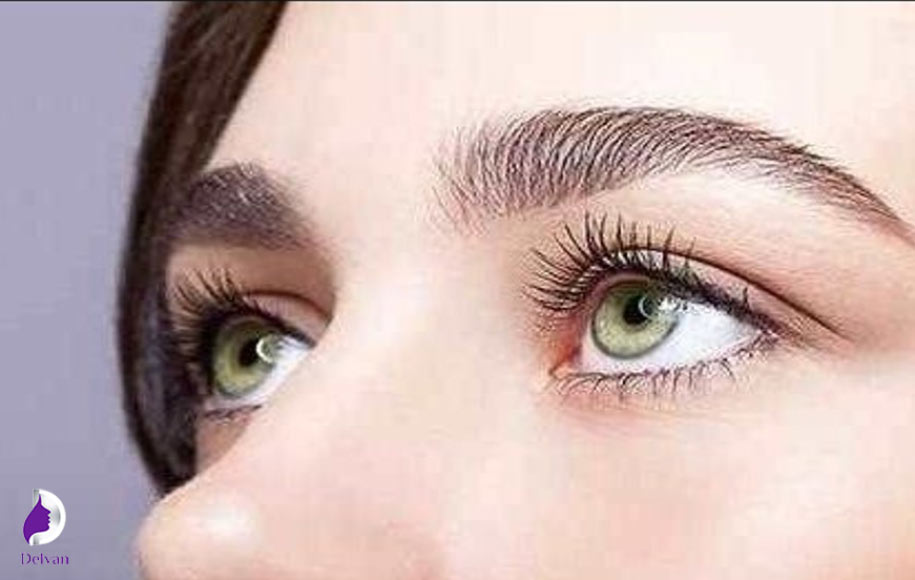 کاشت ابرو بدون انجام جراجی چیست؟