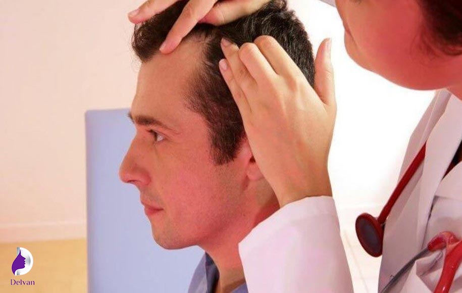 کاشت مو برای افراد دیابتی نوع اول و دوم