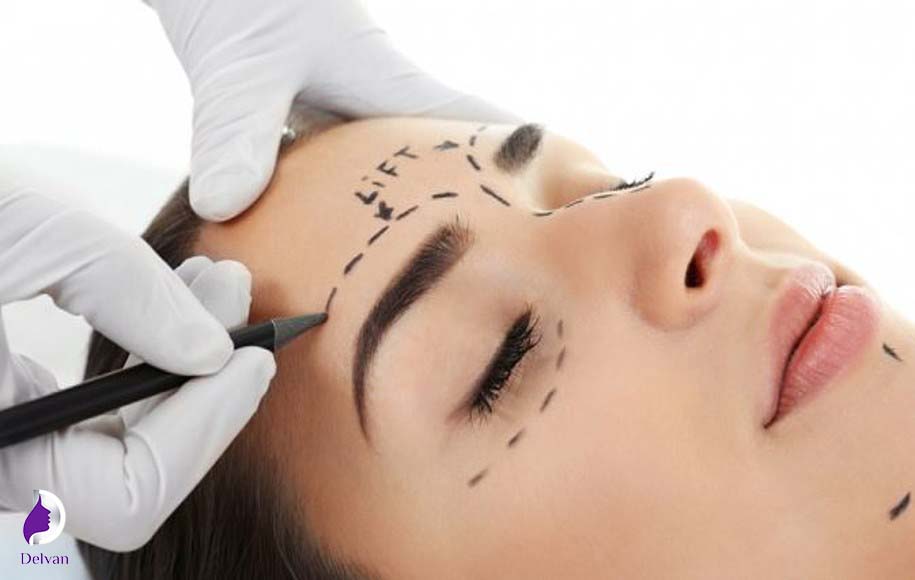مزایای کاشت ابرو به روش FUE
