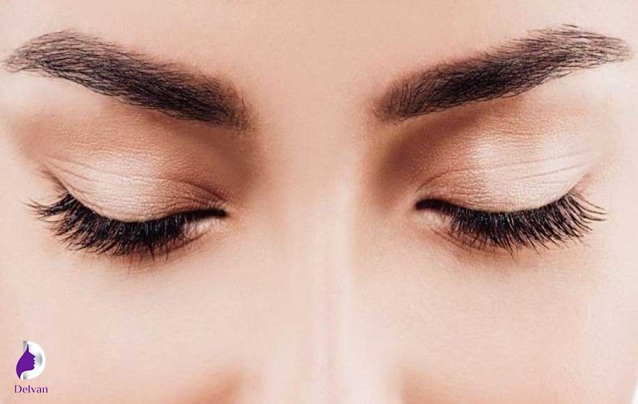 مراقبت‌های پس از کاشت ابرو به روش FUE
