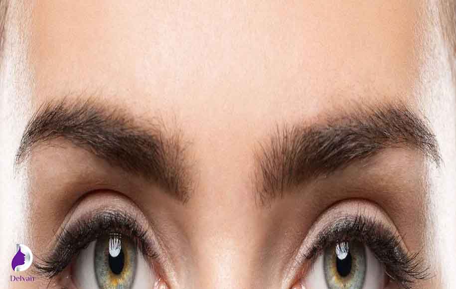 عوارض کاشت ابرو به روش FUE