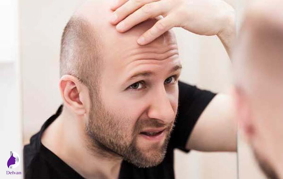 ژنتیک در ریزش مو