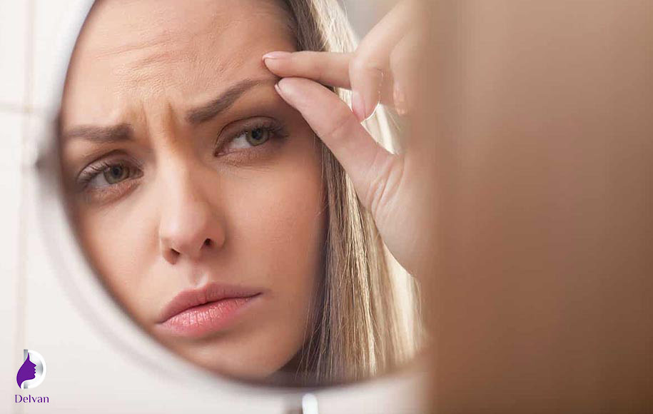 پیشگیری از ریزش موی ابرو