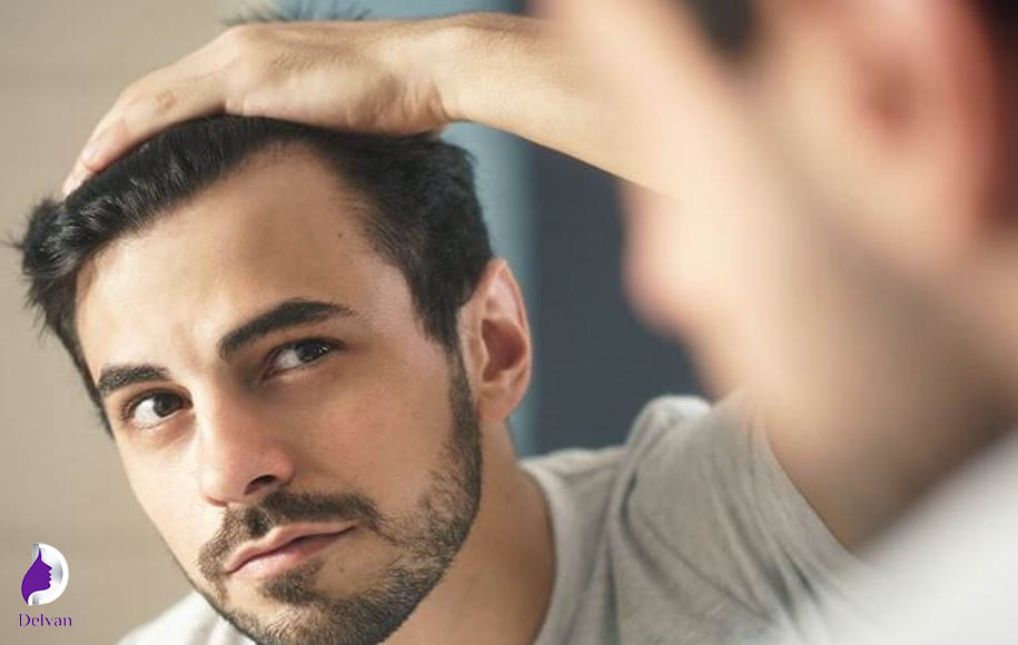 روش جلوگیری از ریزش مو