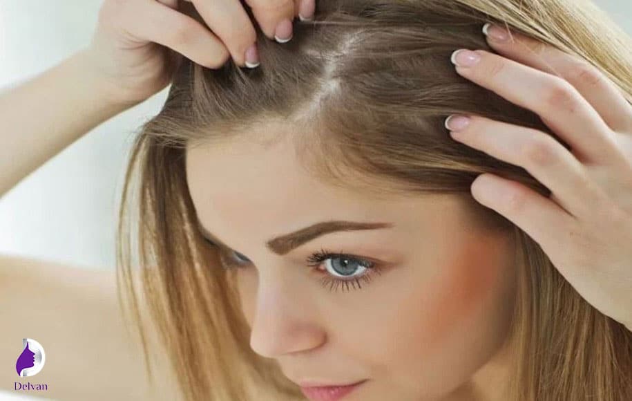 عدم مصرف داروهای ضد التهاب درد مزوتراپی مو