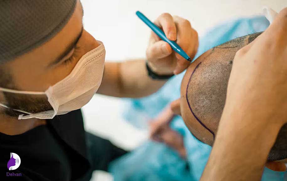 عوارض کاهش دی هیدروتستوسترون