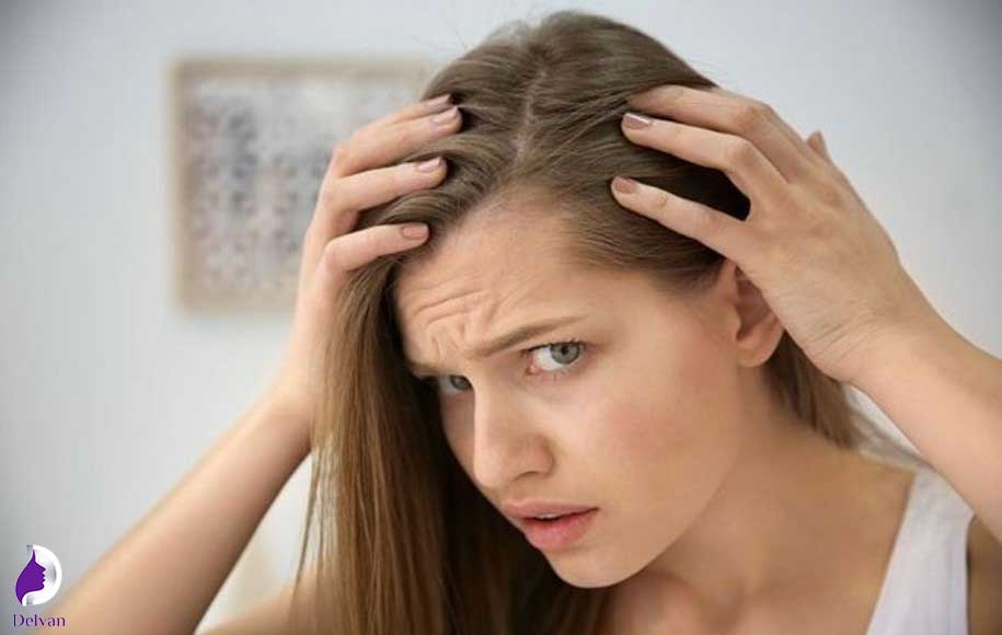 تاثیر ژن بر ریزش مو در زنان