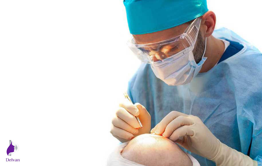 مراحل کاشت مو به روش سلول های بنیادی 