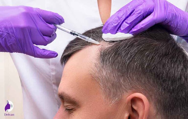 بانک مو چیست؟