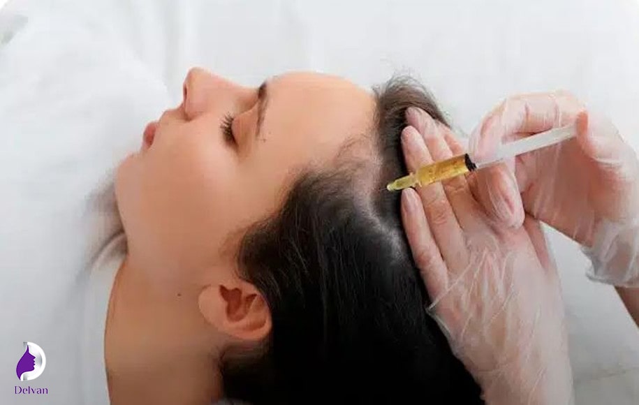 مزاقبت های بعد مزوتراپی مو