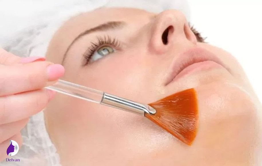 فیشیال دور چشم