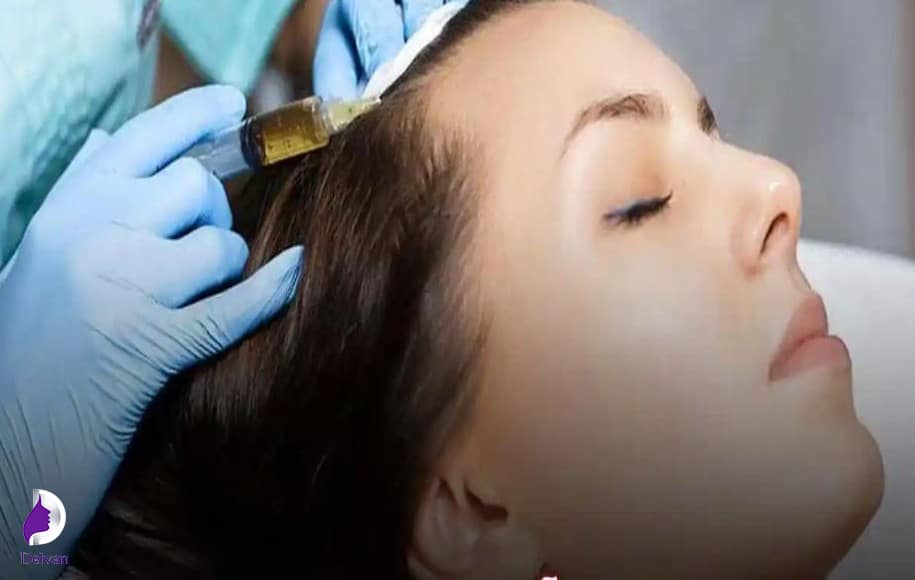 نکات مهم مزوتراپی کردن