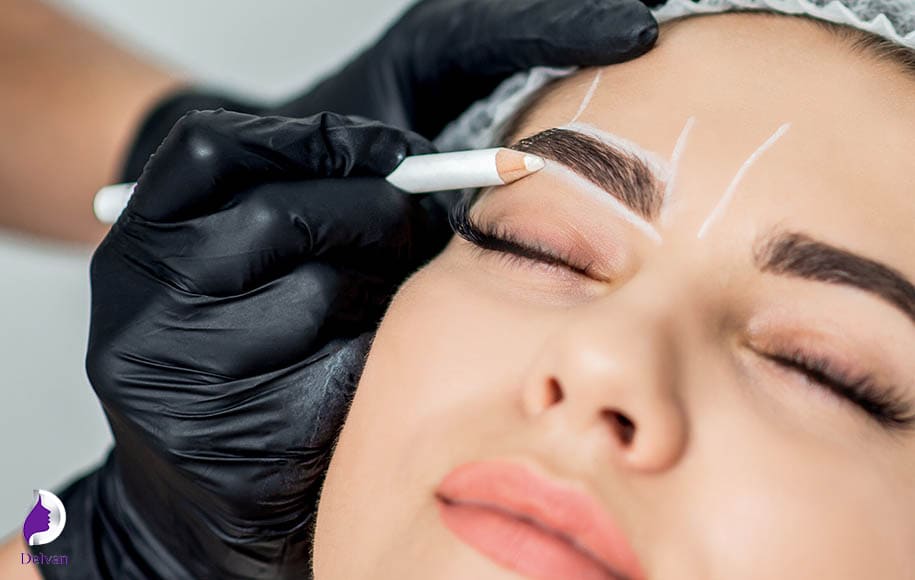 در چه صورتی به ترمیم کاشت ابرو نیاز است؟