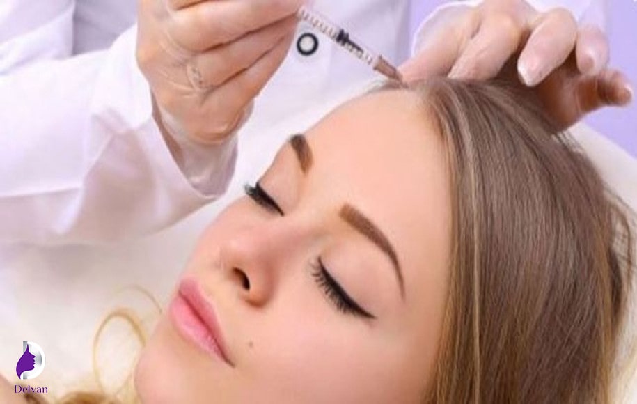 دلایل مزوتراپی مو