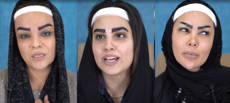ویدیو کاشت ابرو