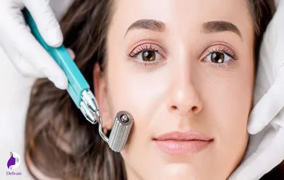 تفاوت فیشیال و میکرونیدلینگ
