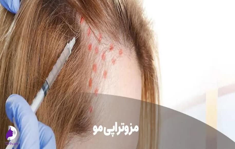 تاثيرات مثبت مزوتراپی در سلامت