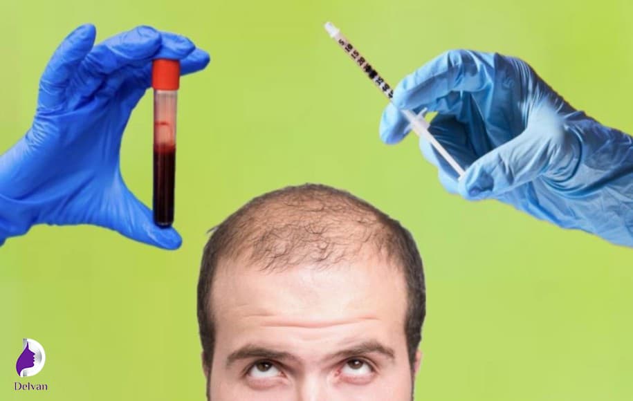 مزوتراپی چیست؟