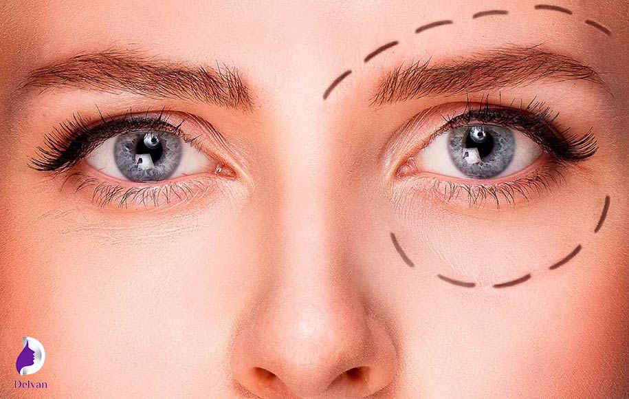 تفاوت در گروه هدف و کاندیداهای مناسب