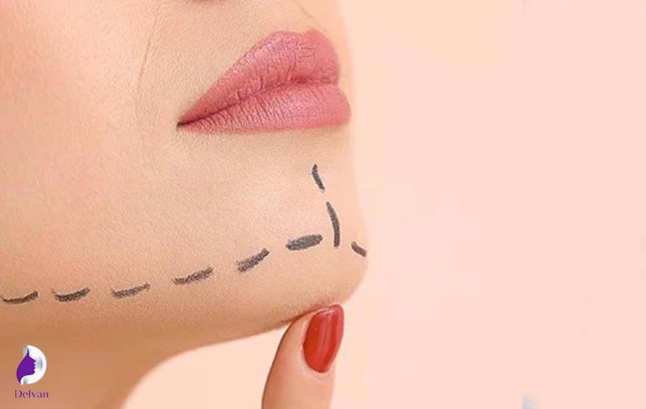 دلایل بستن گن بعد از عمل لیپوساکشن غبغب
