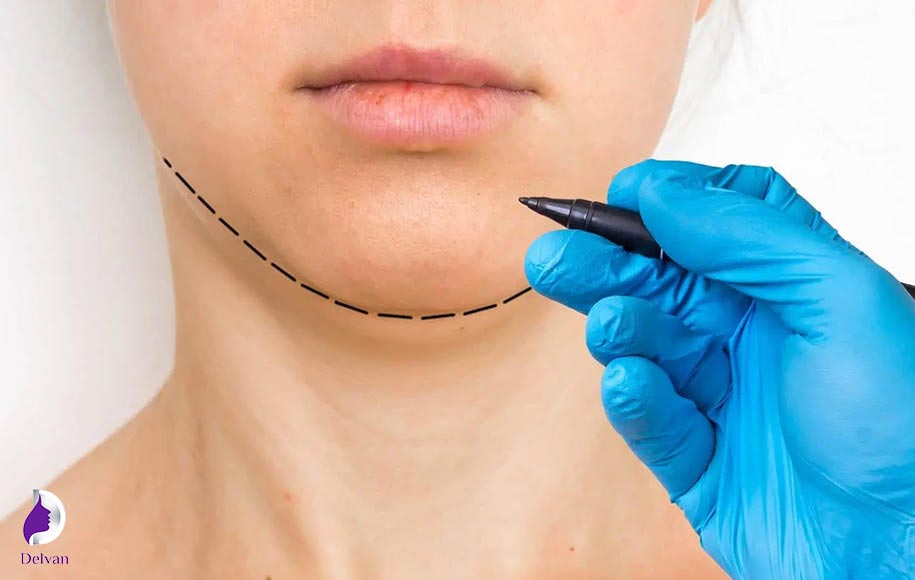 ملاحظات ایمنی برای جلوگیری از عوارض و خطرات لیپوساکشن غبغب