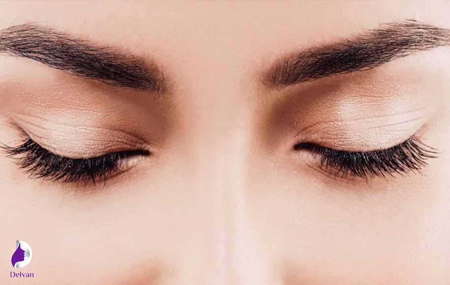 نکات مراقبتی برای کاهش خارش بعد از کاشت