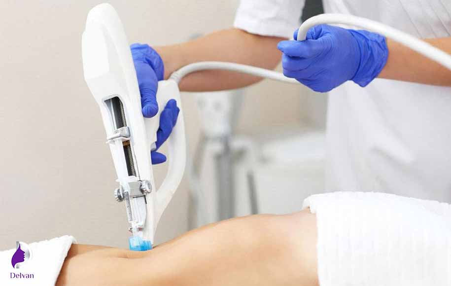 کاربرد کربوکسی تراپی
