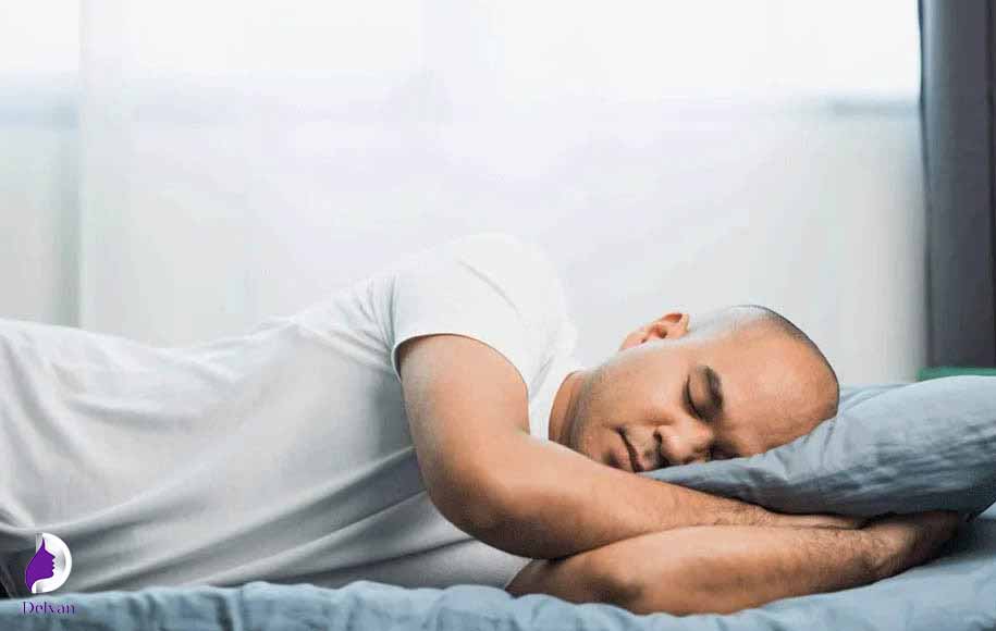 نحوه خوابیدن بعد از کاشت مو