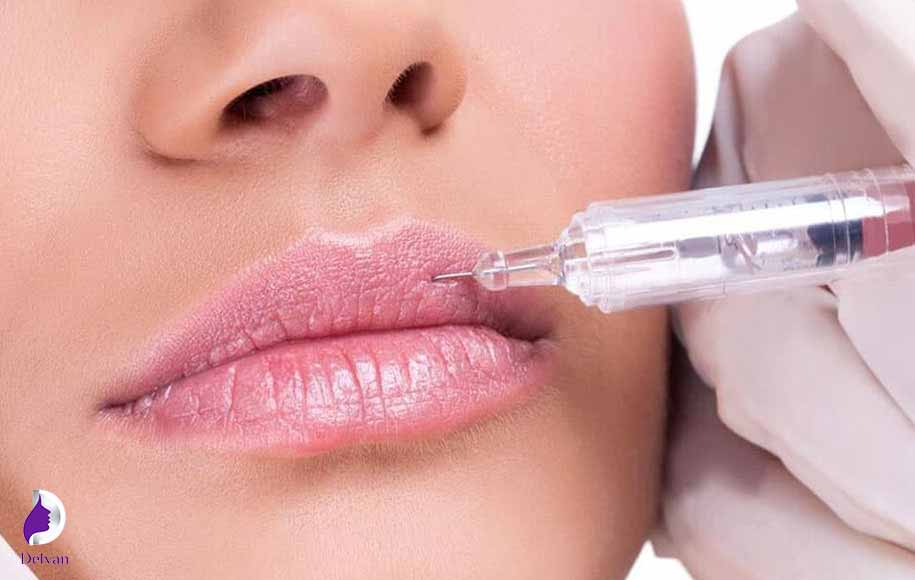 آیا خود ژل لب باعث ایجاد تبخال می‌شوند؟