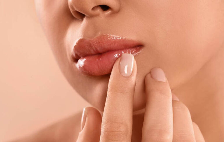 گلوله شدن لب پس از تزریق ژل