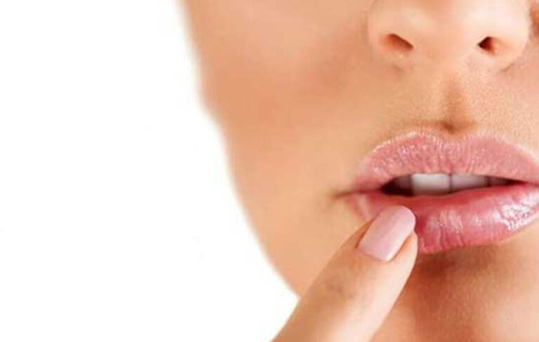 تبخال بعد از تزریق ژل لب