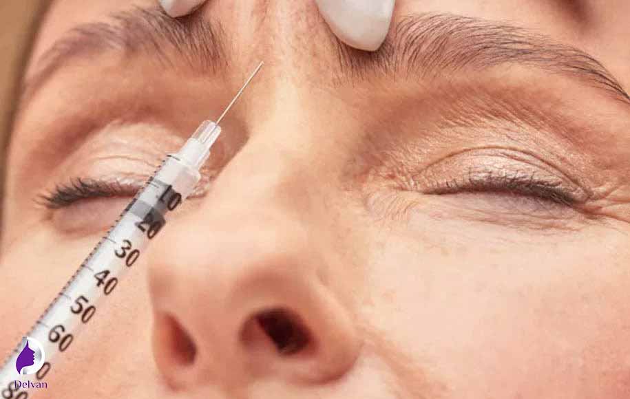نکات مراقبتی بعد از تزریق بوتاکس برای میگرن
