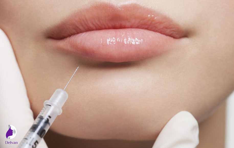 چگونه می‌توان از تبخال بعد از تزریق ژل لب جلوگیری کرد؟